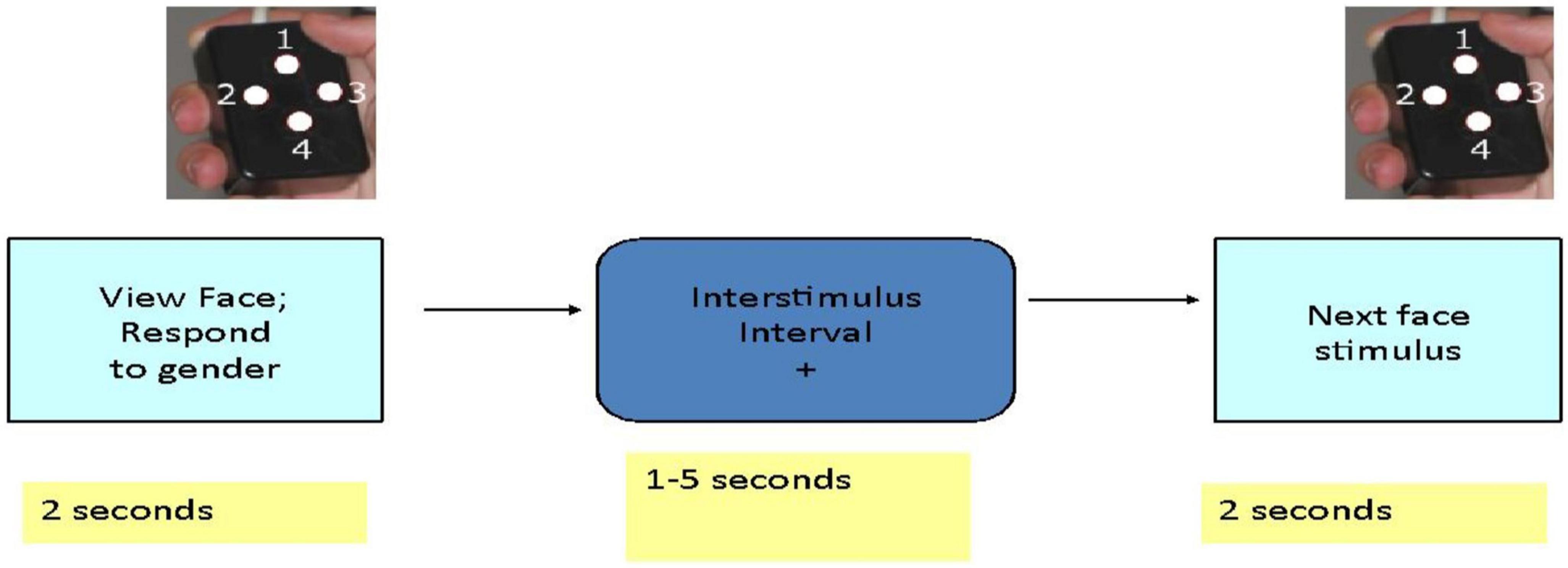FMRI study of implicit emotional face processing in patients with MDD with melancholic subtype